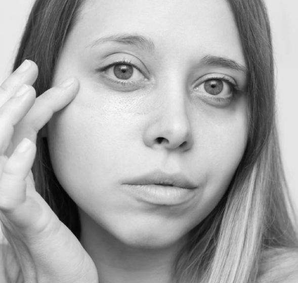 images/img/darkcircles.jpg
